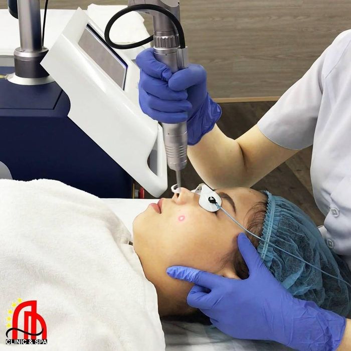 Công nghệ Laser Toning tại Thẩm Mỹ Viện An An ảnh 1