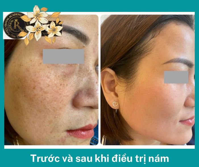 Không gian sang trọng tại Spa Beauty Royal