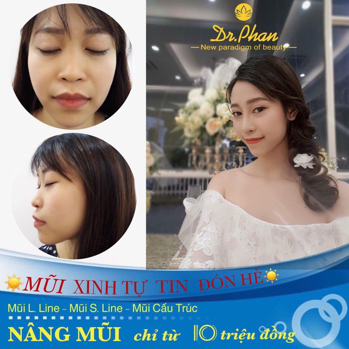 Hình ảnh thực tế về quy trình thẩm mỹ tại Dr. Phan