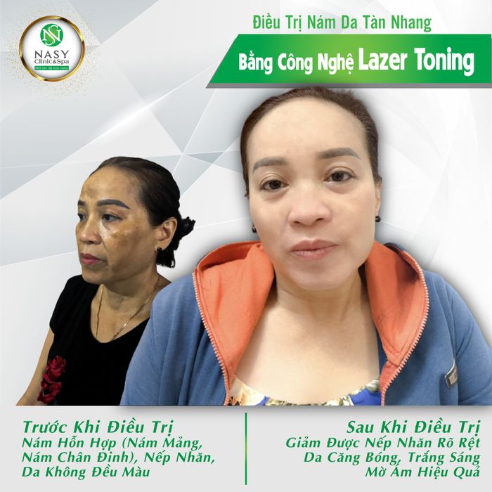 Nasy Spa - Hình ảnh 1