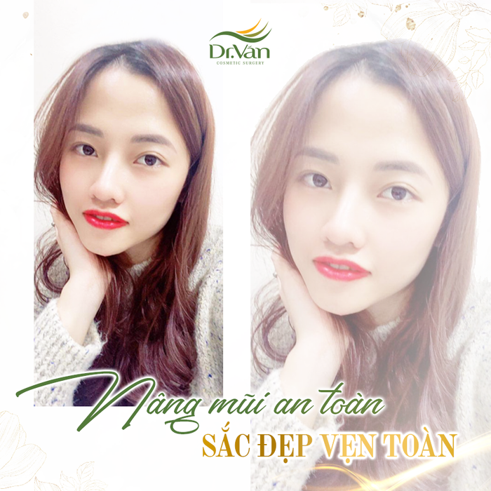 Hình ảnh thực tế tại Viện Thẩm Mỹ Bác Sĩ Văn - góc nhìn chân thực