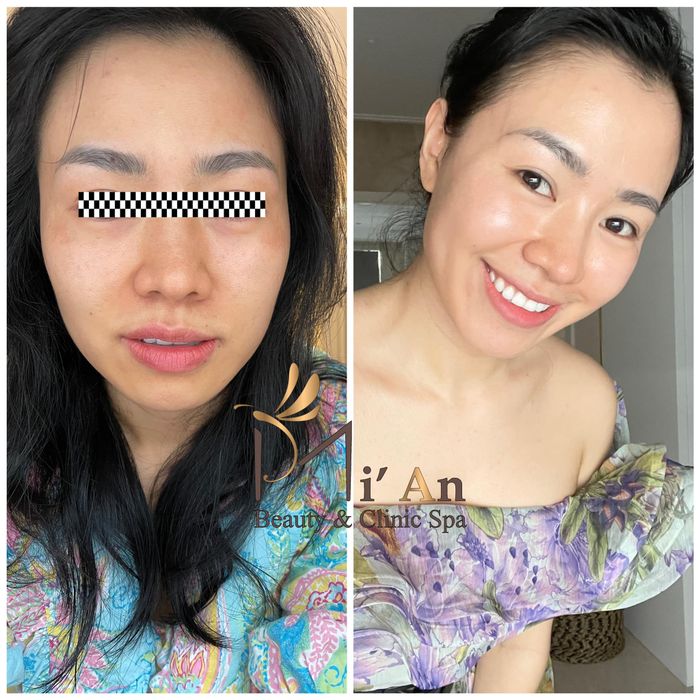 Mi'An Beauty & Clinic Spa - Hình ảnh 2
