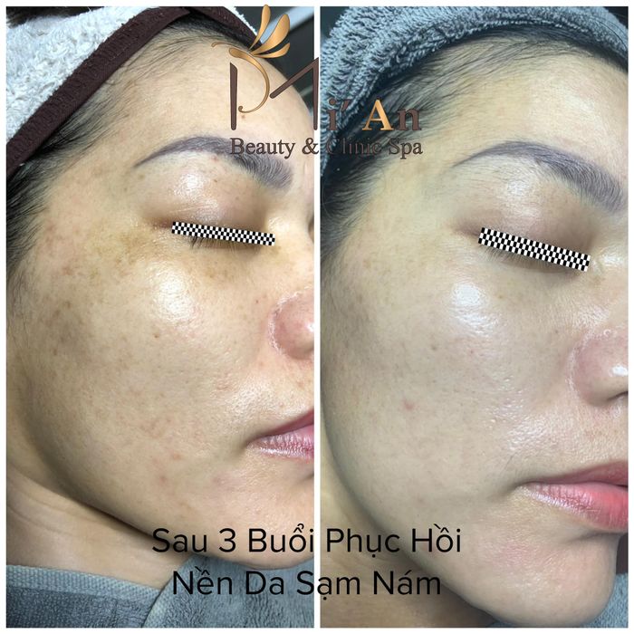 Mi'An Beauty & Clinic Spa - Hình ảnh 1