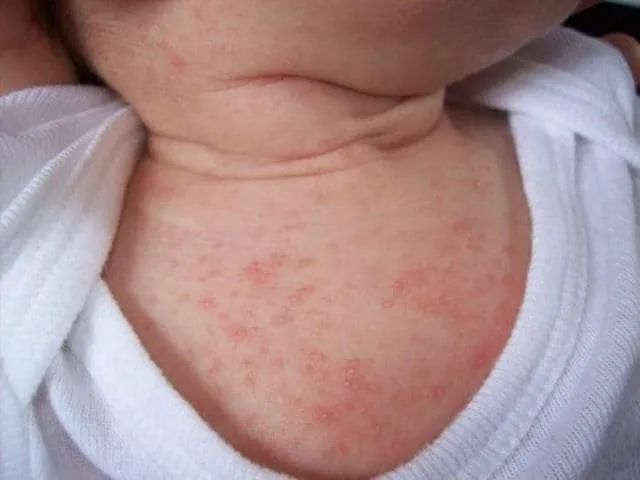 Phòng Khám Nhi Khoa Khang Nhi Thị Trấn Diêm Điền ảnh 2