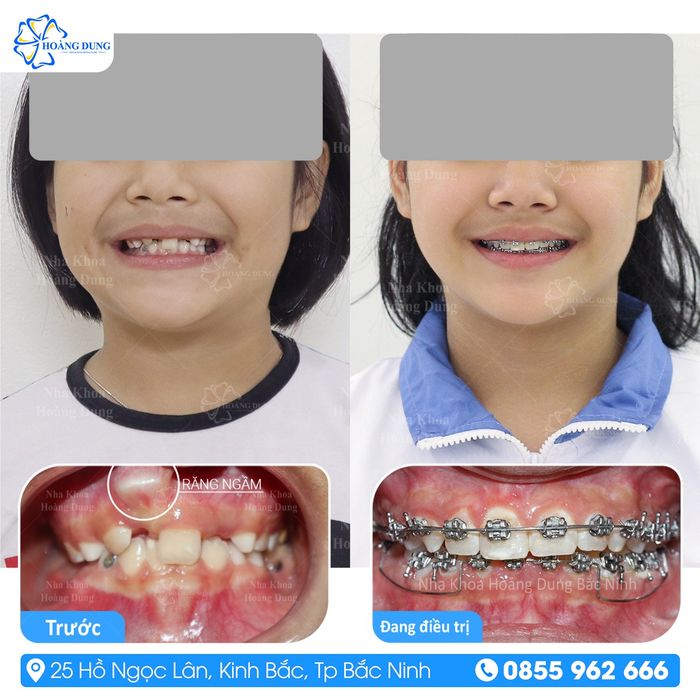 Không gian hiện đại tại Nha Khoa Hoàng Dung