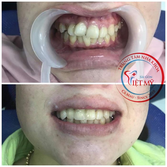 Hệ thống trang thiết bị tân tiến tại Nha khoa Sài Gòn Việt Mỹ