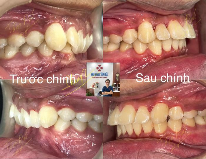 Hình ảnh phòng khám Nha Khoa Tâm Đức
