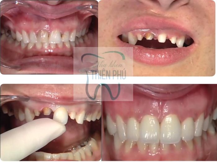 Không gian hiện đại tại Nha khoa Thiên Phú Bạc Liêu
