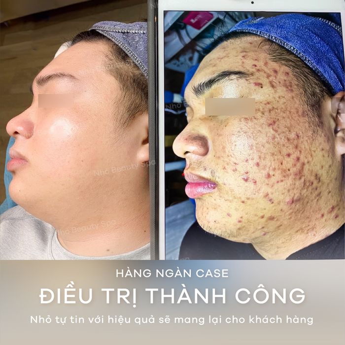 Không gian thư giãn đẳng cấp tại Nhỏ Premium Spa