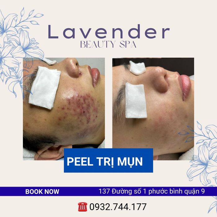 Không gian trị liệu chuẩn Y khoa tại Lavender Medical Spa