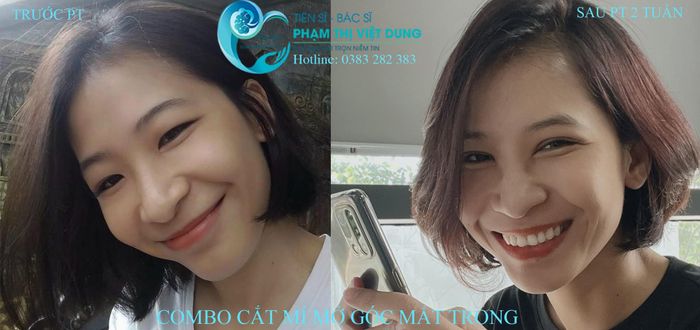 Ts.Bs. Phạm Thị Việt Dung - Khoảnh khắc lắng đọng trong phòng mổ (Ảnh 2)