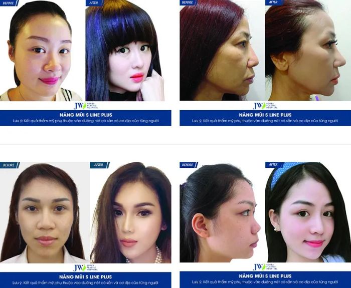 Bệnh Viện Thẩm Mỹ JW Hàn Quốc (Bệnh viện JW) ảnh 2