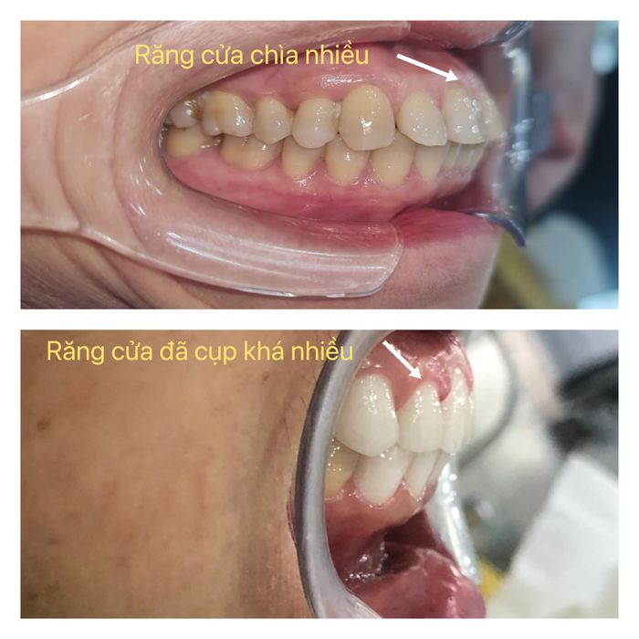 Hệ thống trang thiết bị tiên tiến tại Nha Khoa Bắc Ninh