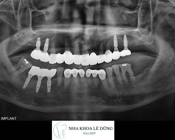 Hình ảnh thực tế tại Nha Khoa Lê Dũng - không gian hiện đại, vô trùng tuyệt đối