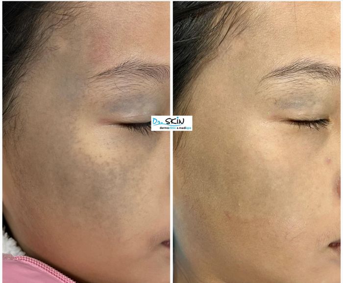 Hệ thống máy móc hiện đại tại Dr. Skin Dermaclinic & Medispa