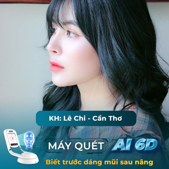 Hình ảnh thực tế về thành công nâng mũi tại Grand Korea