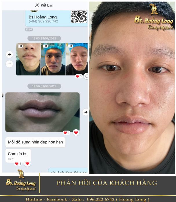 Bác sĩ Hoàng Long - Ánh mắt tập trung của người nghệ sĩ y khoa (Ảnh 2)