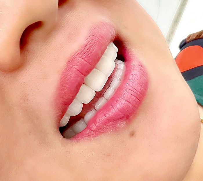 Không gian sang trọng tại Nha Khoa Bảo Anh Bắc Ninh