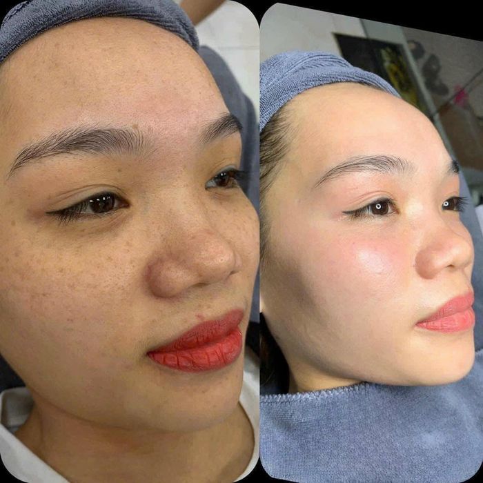 Không gian trị liệu cao cấp tại Mỹ Ngọc Spa