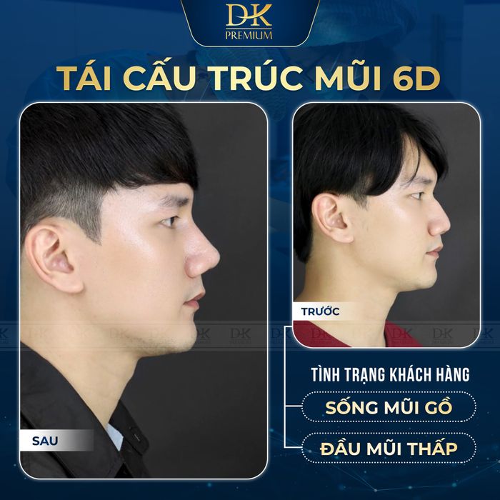 Dr Korea - Hình ảnh thực tế về những ca phẫu thuật tạo hình thành công