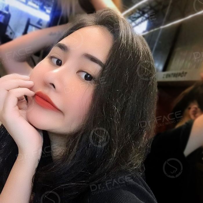 Hình ảnh thực tế Viện Nâng Mũi Bác Sĩ Trần Phương