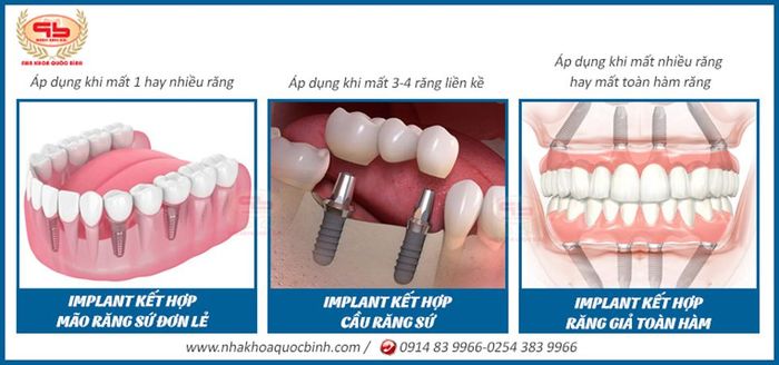 Hình ảnh đội ngũ bác sĩ chuyên môn cao tại Nha Khoa Quốc Bình Vũng Tàu