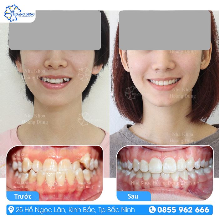 Hệ thống trang thiết bị tiên tiến tại Nha Khoa Hoàng Dung
