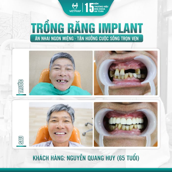Hệ thống trang thiết bị tân tiến tại Nha Khoa Việt Pháp