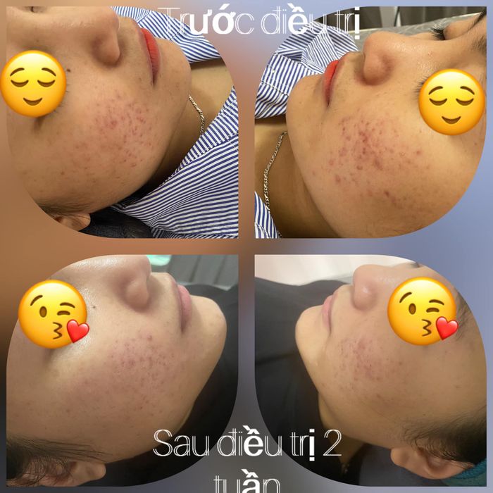 Khám phá Phòng Khám Da Liễu Bs Hải Lý qua góc nhìn ấn tượng từ hình ảnh 2