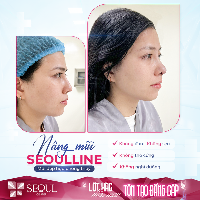Không gian hiện đại và sang trọng tại Bệnh Viện Thẩm Mỹ Quốc Tế Seoul Center