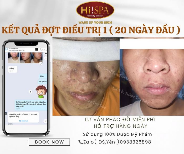 Không gian sang trọng tại Hi Spa - Nơi đẹp từ khoảnh khắc đầu tiên