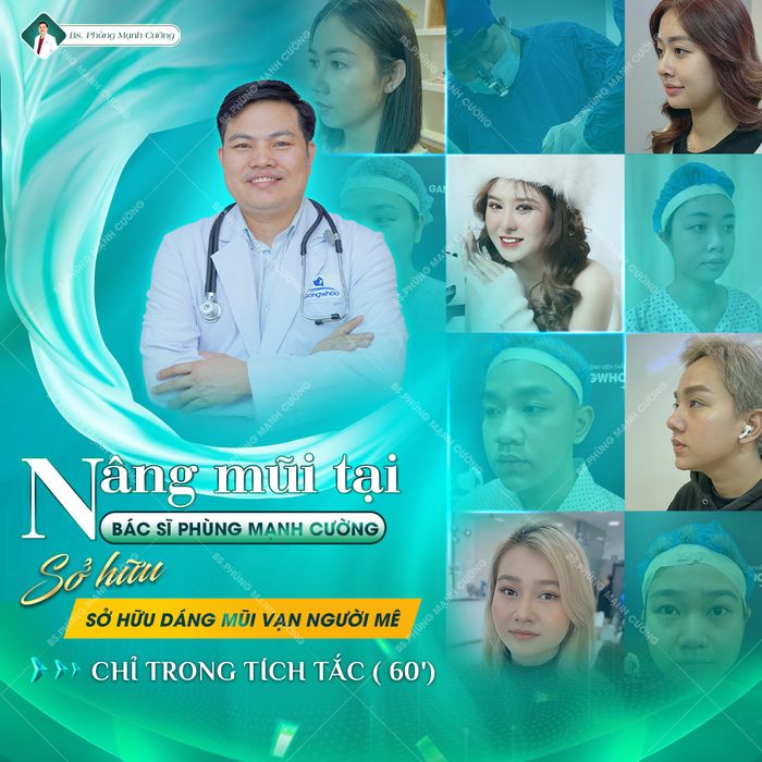 Hình ảnh thực tế ca nâng mũi tại Bác Sĩ Phùng Mạnh Cường (Ảnh 2)