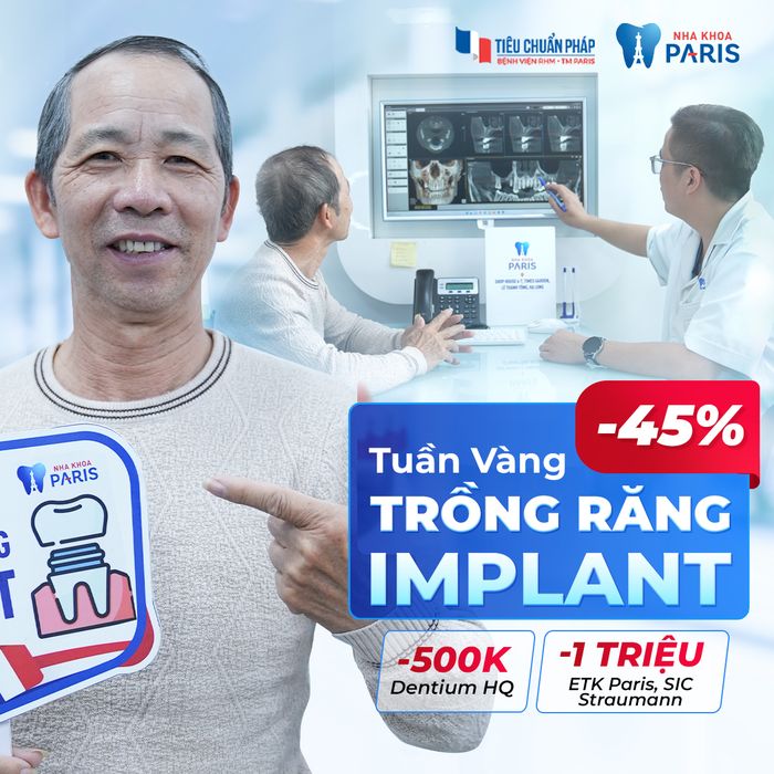 Hình ảnh quy trình cấy ghép Implant 4S tại Nha Khoa Paris