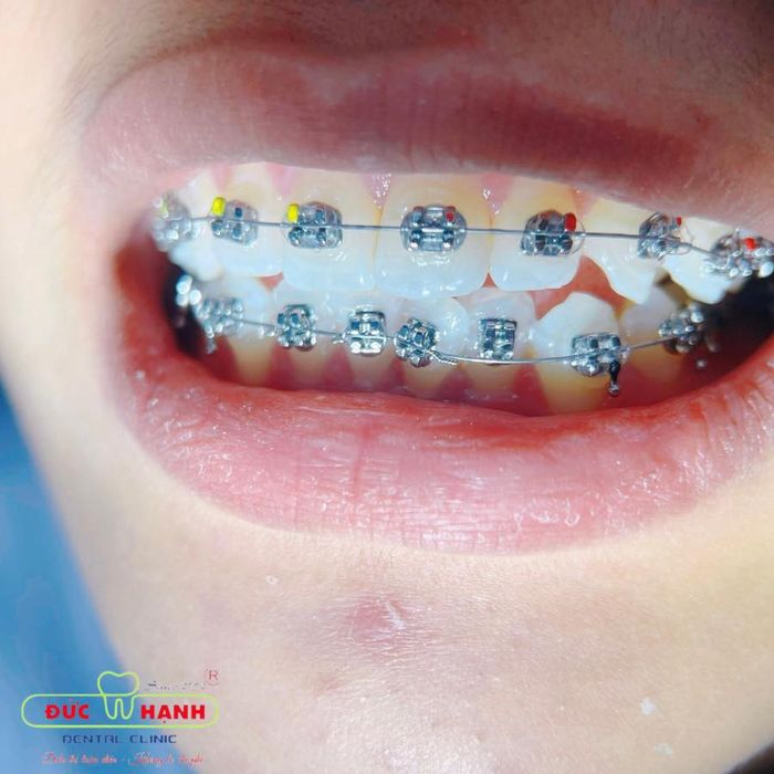 Hệ thống trang thiết bị hiện đại tại Nha khoa Đức Hạnh