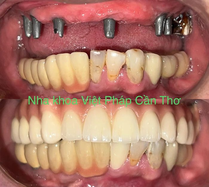 Không gian sang trọng tại Nha Khoa Việt Pháp
