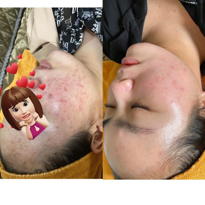 Không gian trị liệu chuyên nghiệp tại Nhi Spa
