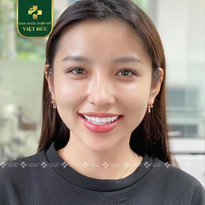 Hình ảnh chân thực về không gian hiện đại tại Nha Khoa Việt Đức