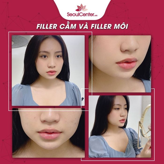 Không gian sang trọng đạt chuẩn 5 sao tại SeoulCenter