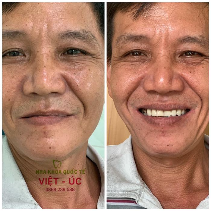 Hình ảnh 1 về Nha Khoa Việt Úc Bến Tre
