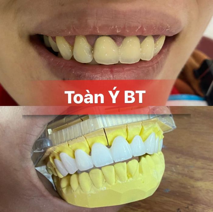 Hình ảnh 1 về Nha Khoa Toàn Ý Bến Tre