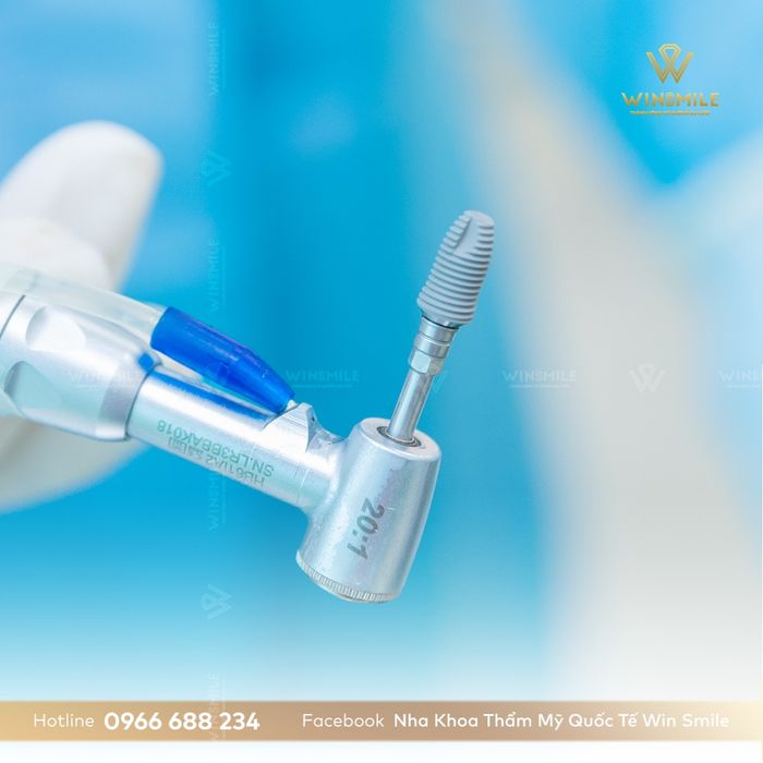 Hình ảnh quy trình cấy ghép Implant chuyên nghiệp tại Win Smile
