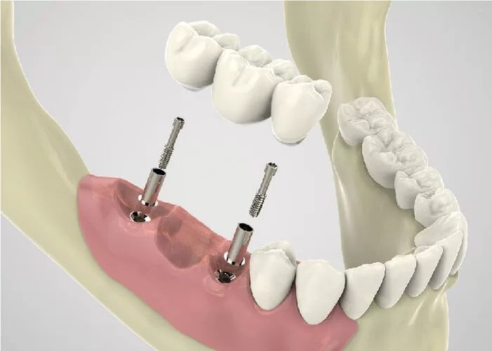 Hệ thống trang thiết bị tân tiến tại Nha khoa KIM