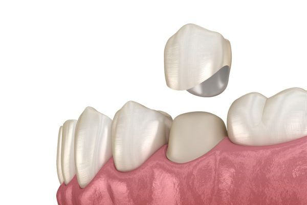Elite Dental ảnh 2