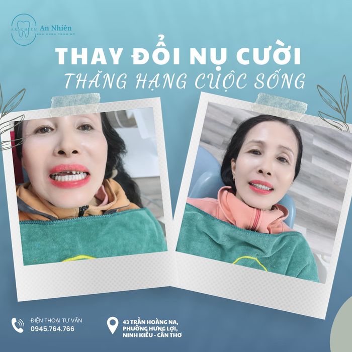 Hình ảnh ấn tượng về Nha Khoa An Nhiên - Nơi trao gửi nụ cười tỏa sáng