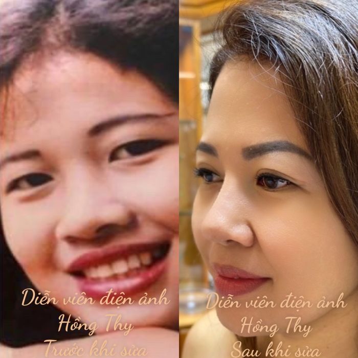 Hình ảnh Thẩm mỹ viện Phương Dung - Bác sĩ Trần Thúc Bảo