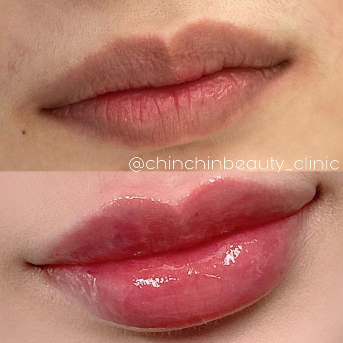 Không gian hiện đại và sang trọng tại Chin Chin Clinic