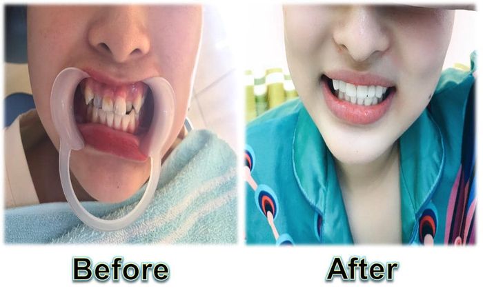 Hình ảnh 2 về Nha Khoa Bảo Anh