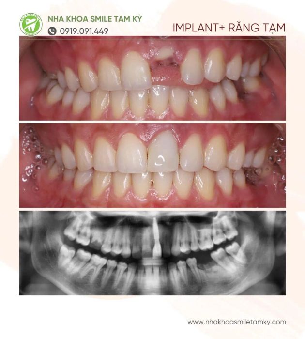 Hệ thống máy móc tân tiến tại Nha Khoa Smile Tam Kỳ
