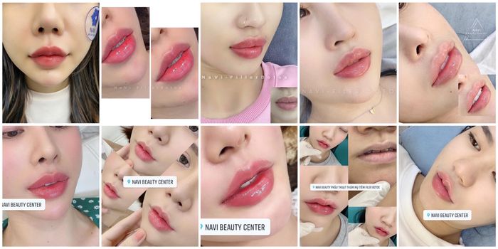 Hình ảnh Viện Thẩm Mỹ NaVi