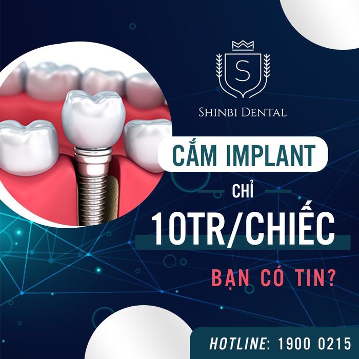 Hình ảnh minh họa quy trình trồng răng tại Shinbi Dental